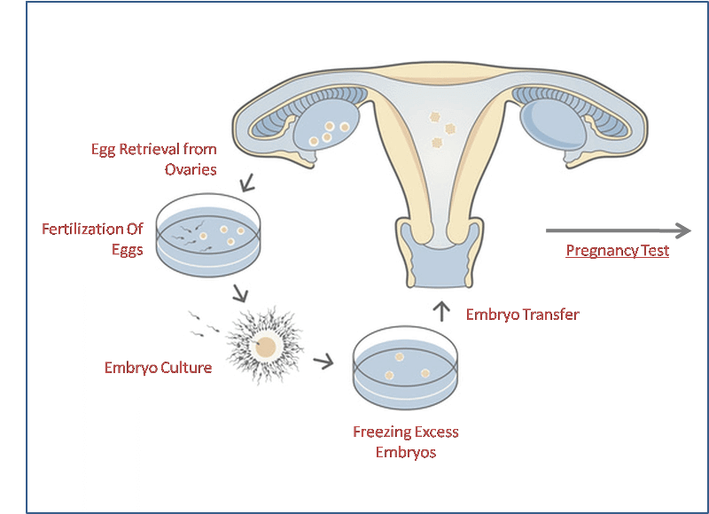IVF Process, IVF Procedure, IVF Step by Step