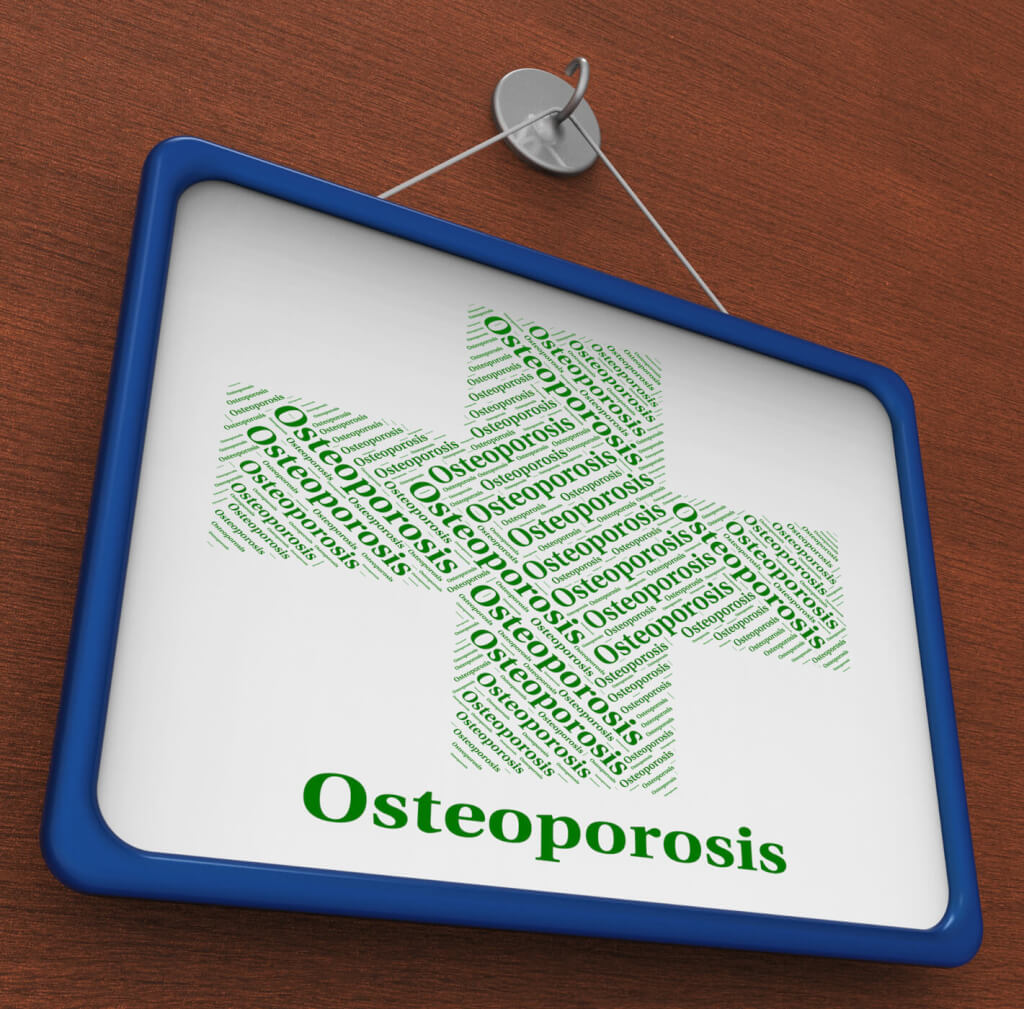 Osteoporosis, Health Condition, Weak Bones, accidental fractures
