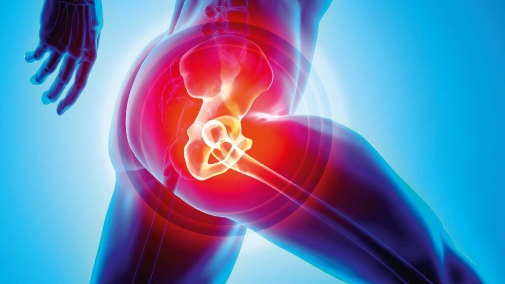 hip replacement treatment