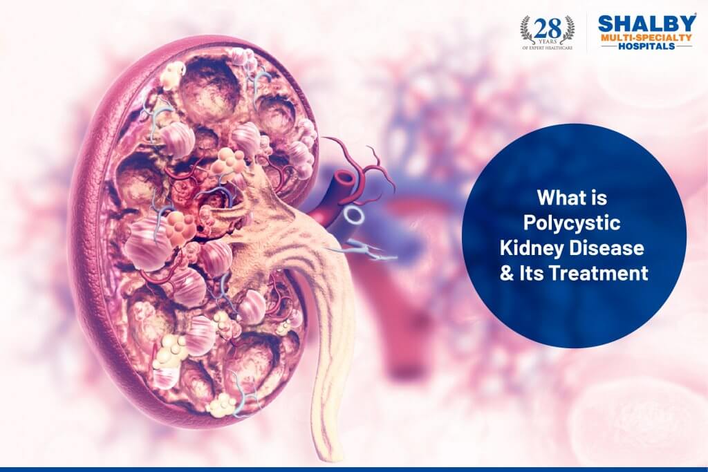 What is polycytic kidney disease & it's treatment