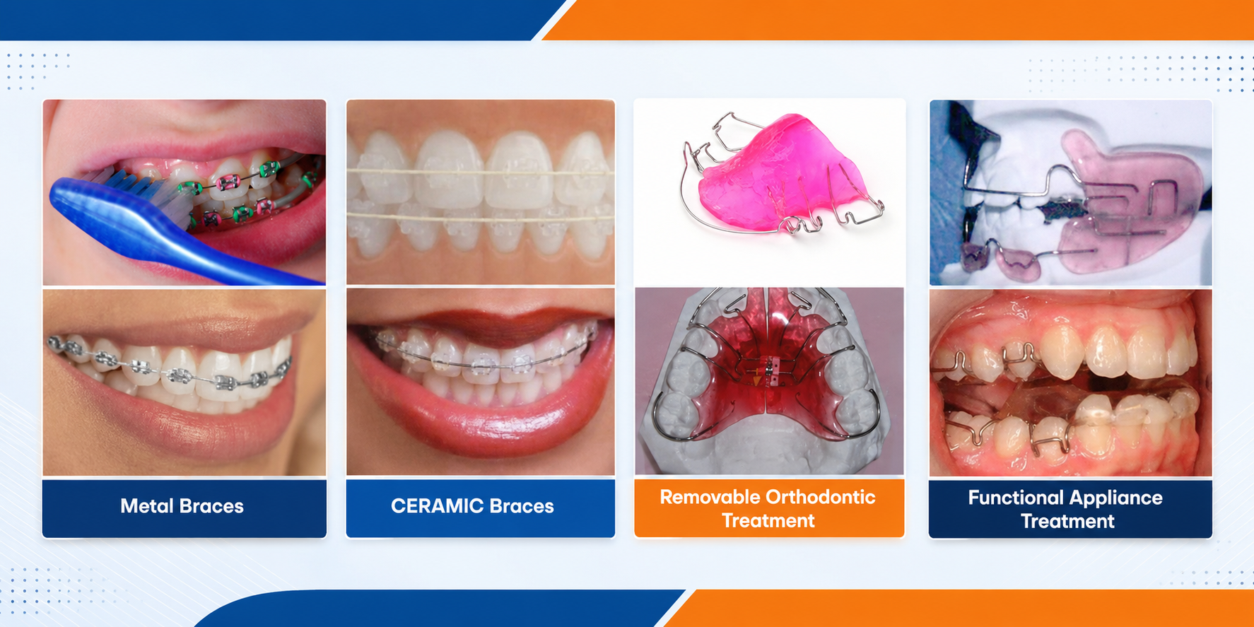 Orthodontic Treatment