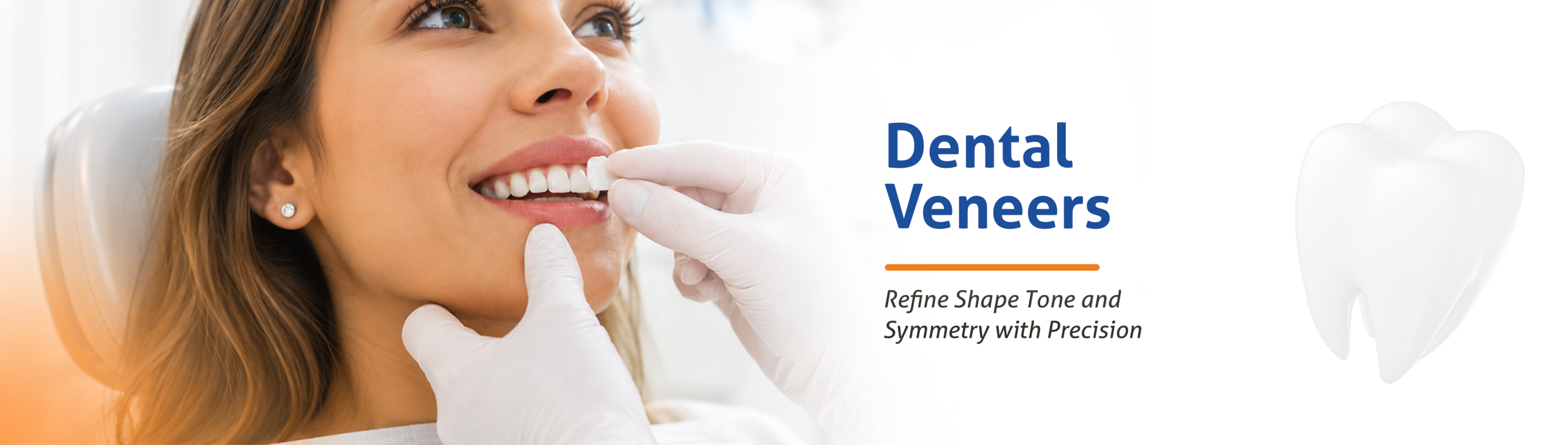 Dental Veneers