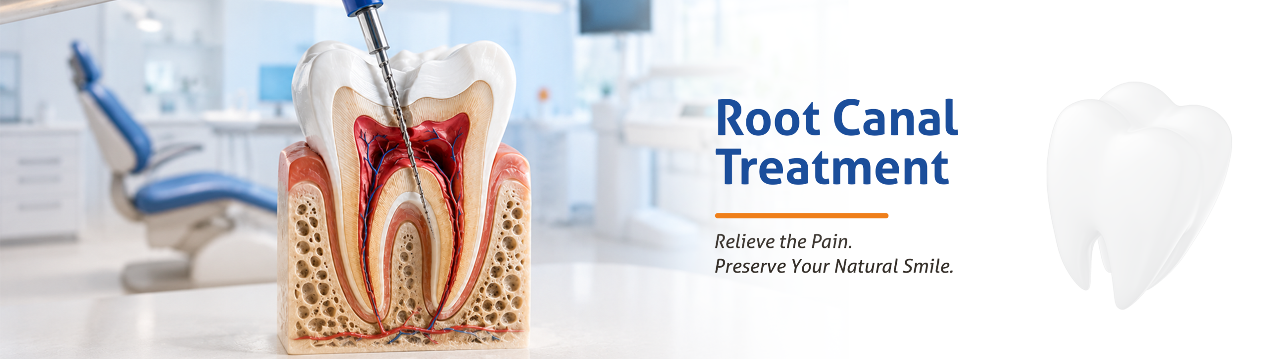 Root Canal Treatment