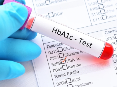 Early Cardiac Screening with Hba1c package for early heart disease detection and diabetes risk assessment