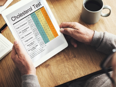 Lipid Profile Package for cholesterol screening and cardiovascular health assessment