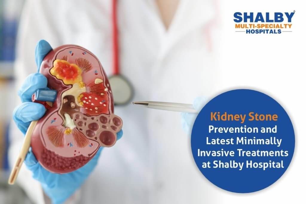 Kidney Stone Prevention and Latest Minimally Invasive Treatments at Shalby Hospital