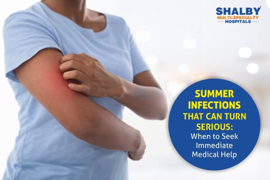 Summer Infections That Can Turn Serious: When to Seek Immediate Medical Help