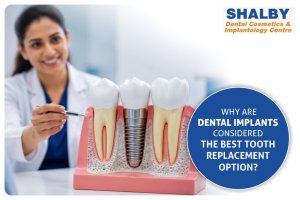 Why Are Dental Implants Considered the Best Tooth Replacement Option?