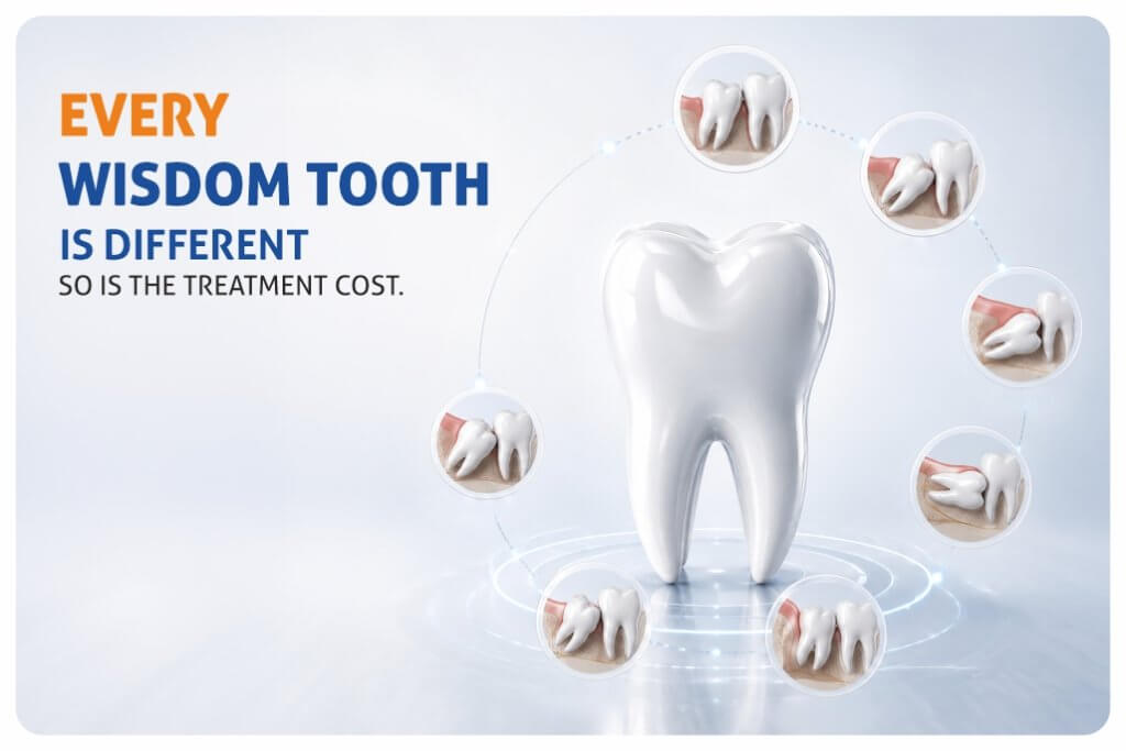 wisdom tooth remove Ahmedabad