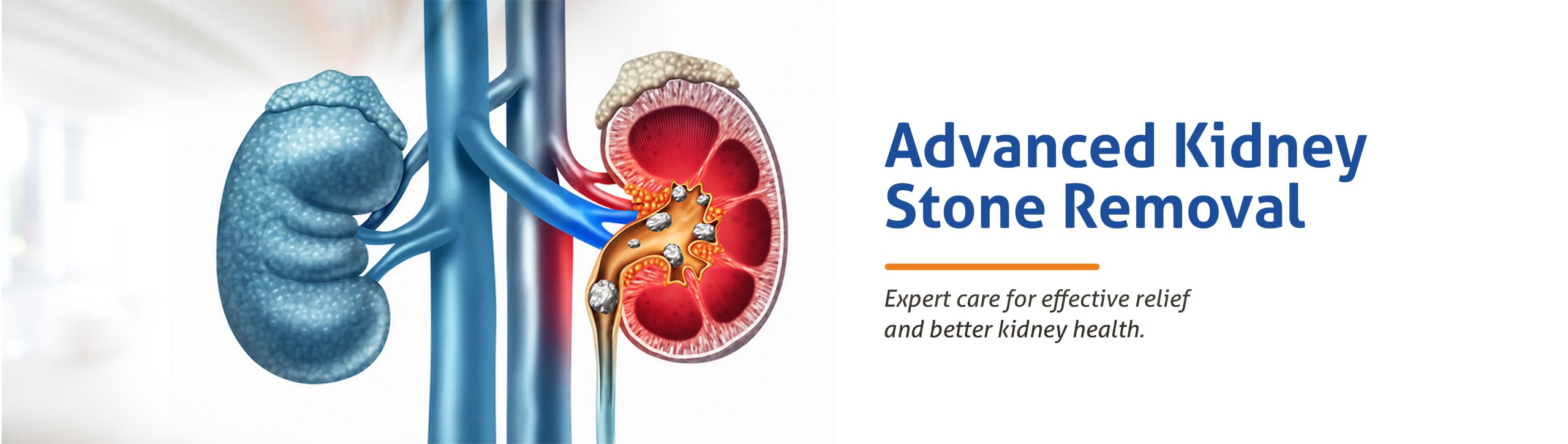 Best Kidney Stone Treatment Hospital in India