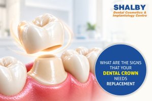 What Are the Signs That Your Dental Crown Needs Replacement?