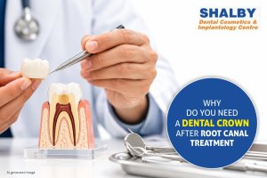 Why Do You Need a Dental Crown After Root Canal Treatment?